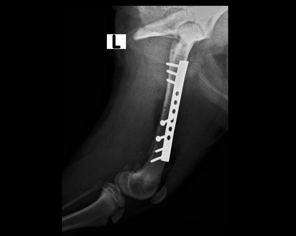 femore-post-op