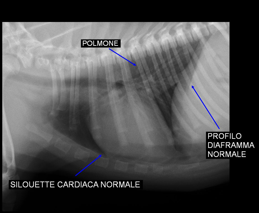 torace-post-op