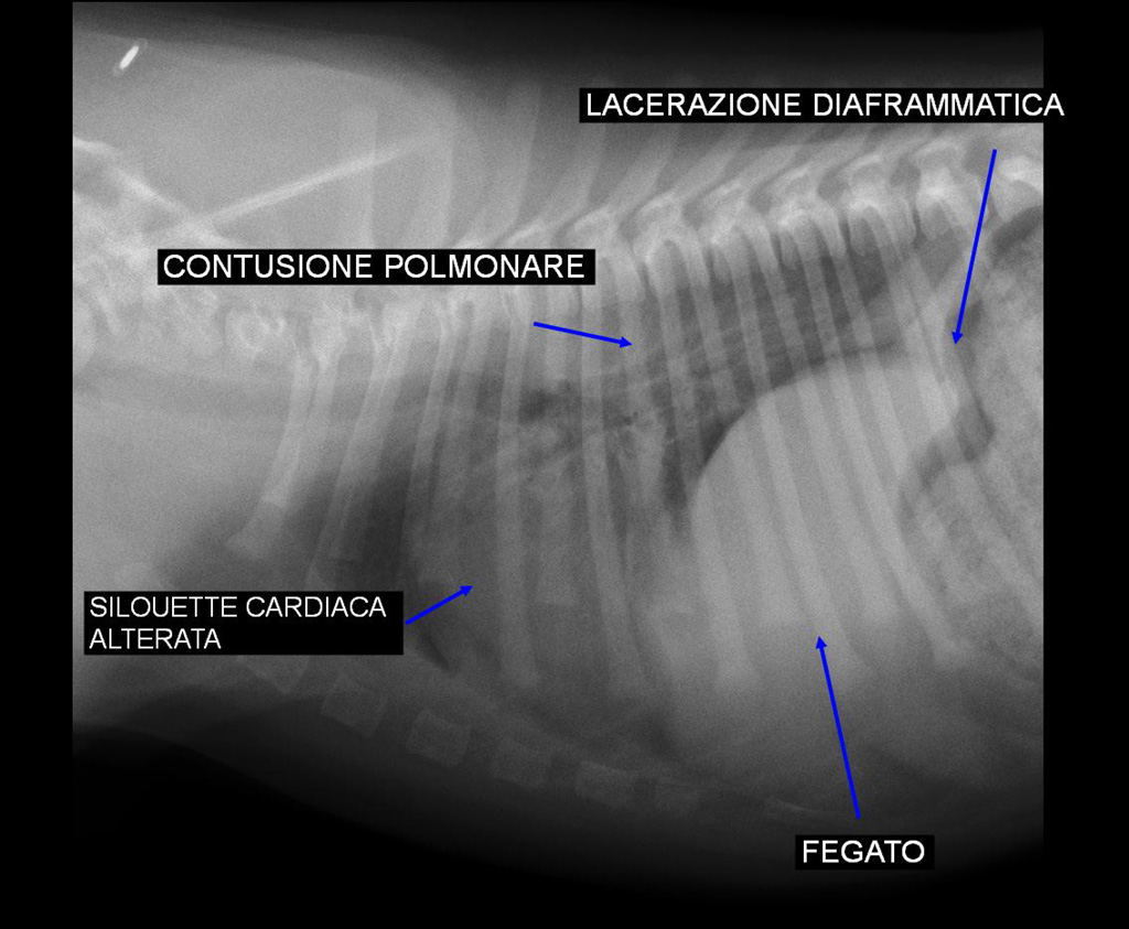torace-pre-op-2